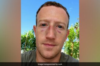 Mark Zuckerberg Get 2 Black Eyes After Jiu-Jitsu Training, Shares Selfie