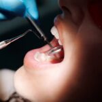 Woman Sues Dentist For Performing Over 30 Surgical Procedures In A Visit