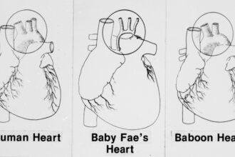 October 26, Newborn receives baboon heart in experimental transplant