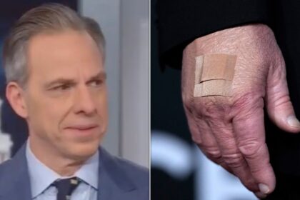Jake Tapper Rejects White House Reason For Trump's Bruises: 'There Is Something Going On'